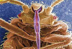 800px-CDC_11739_Cimex_lectularius_SEM